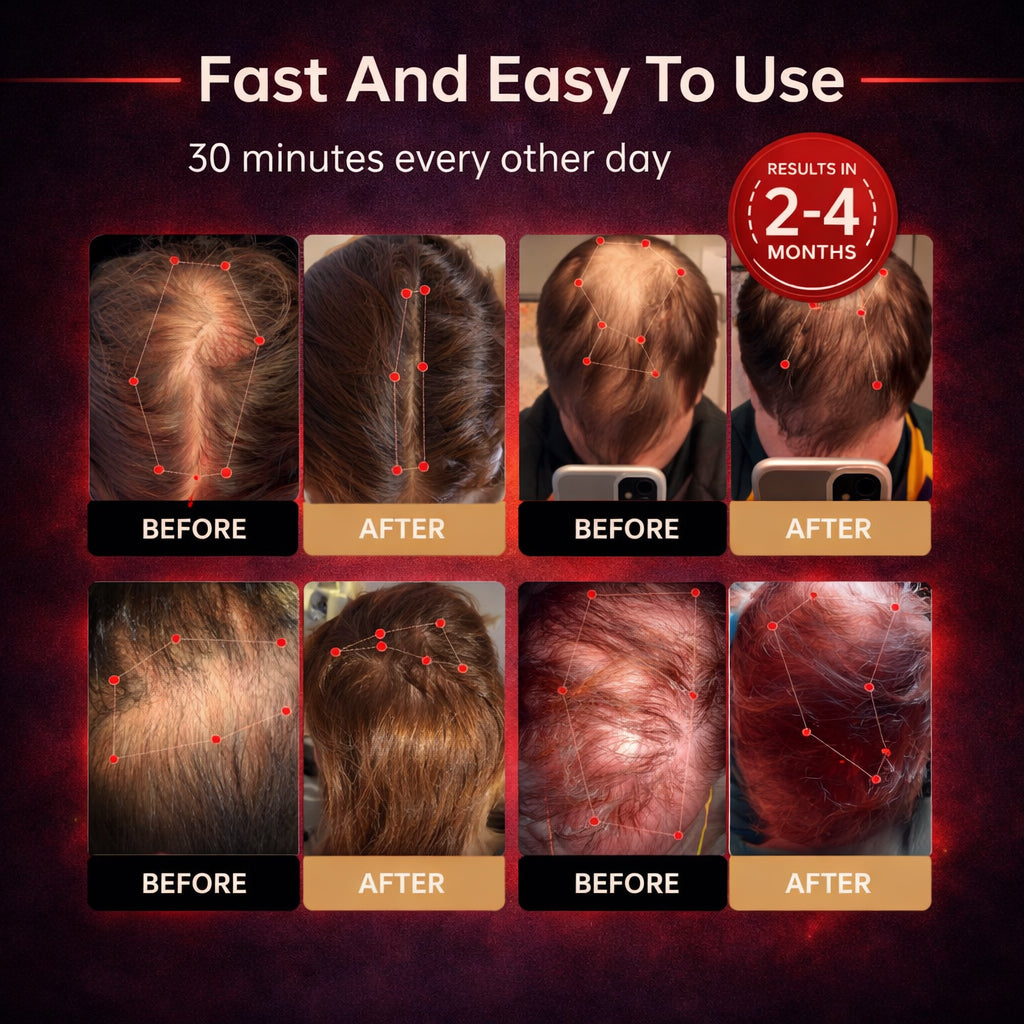 🔥Last Day — SAVE 80% OFF! Mresio® Red Light Cap — Regrow Hair, Reduce Shedding & One Purchase Protects the Whole Family for Years